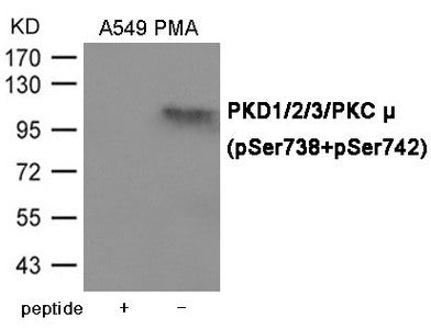 Phospho-PRKD1/PRKD2/PRKD3 (Ser738/742) Antibody