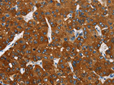 CARD9 Antibody