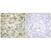 VIM Antibody