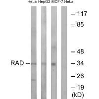 RRAD Antibody