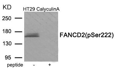 Phospho-FANCD2 (Ser222) Antibody