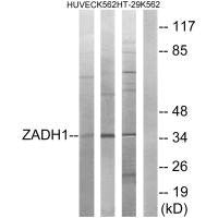 PTGR2 Antibody