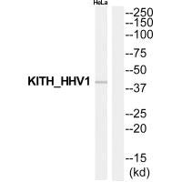 TK Antibody