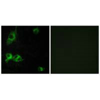 LAMA1 Antibody