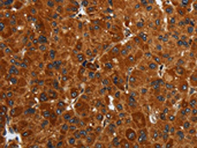 ENTPD7 Antibody