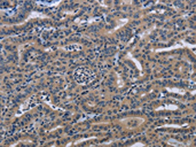KLHL2 Antibody
