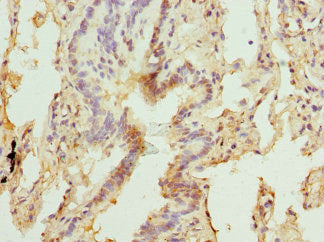 MBTPS1 Antibody