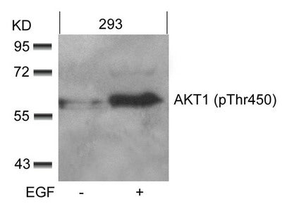 Phospho-AKT1 (Thr450) Antibody
