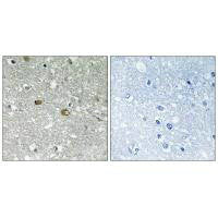 PIGH Antibody