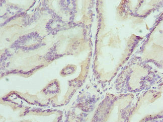 KLK4 Antibody