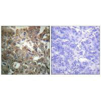 XPA Antibody