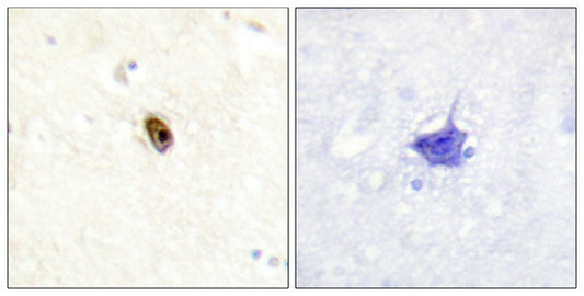 Phospho-AURKC (Thr236/202) Antibody