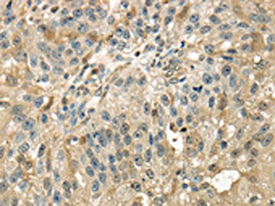 RAB17 Antibody