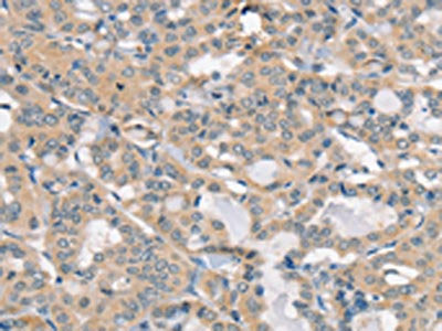 SLC6A8 Antibody