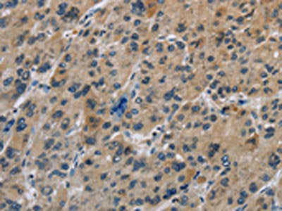 IL31 Antibody