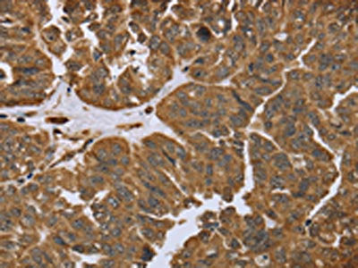 IKBIP Antibody
