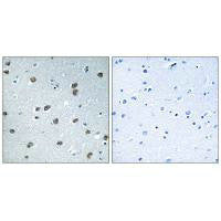 KLHL29 Antibody