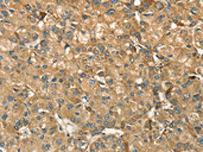 HSD17B8 Antibody