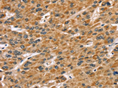 SDCBP Antibody