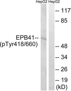 Phospho-EPB41 (Tyr660/418) Antibody