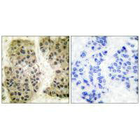 MCM3AP Antibody