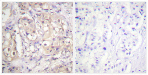 Phospho-BRAF (Thr599) Antibody