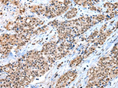 CTBP1 Antibody