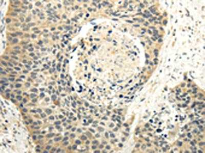 MAP3K7 Antibody