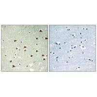 ABHD14B Antibody