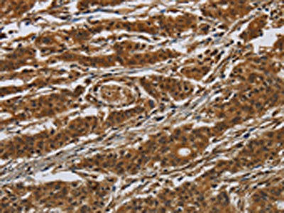 GATA5 Antibody
