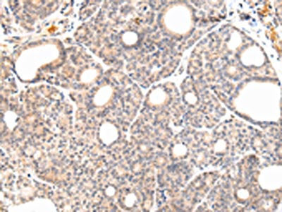 VPS33A Antibody