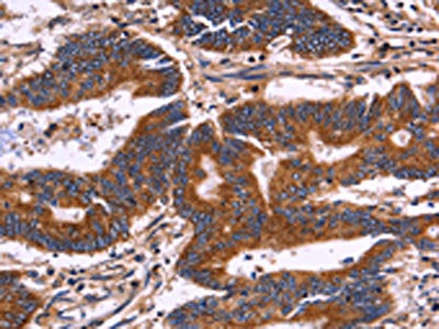 KIR2DL3/KIR2DL1/KIR2DL4/KIR2DS4 Antibody