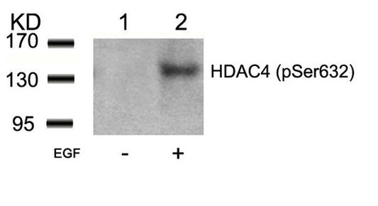 Phospho-HDAC4 (Ser632) Antibody