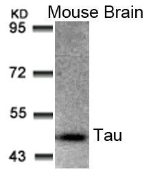 MAPT (Ab-205) Antibody