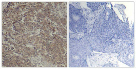 CREB1 (Ab-142) Antibody
