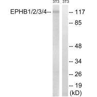 EPHB1/EPHB2/EPHB3/EPHB4 (Ab-600/602/614/596) Antibody