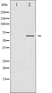 NF2 Antibody