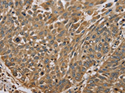 MYL3 Antibody