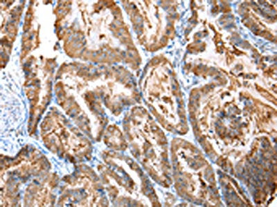 CXCR4 Antibody