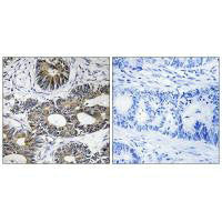 EIF1AY Antibody