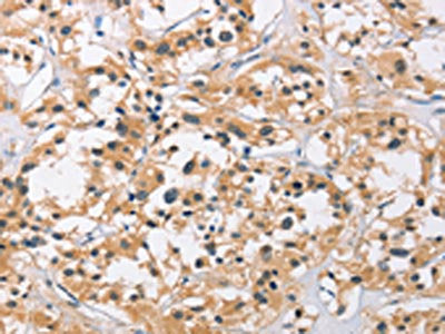 C3AR1 Antibody
