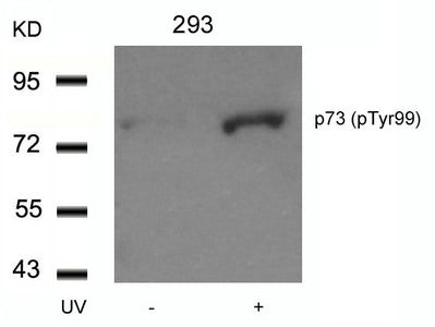 Phospho-TP73 (Tyr99) Antibody