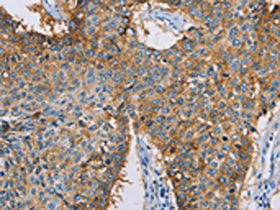 CDCP1 Antibody