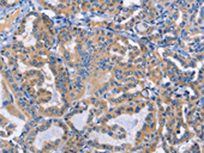 DOK4 Antibody