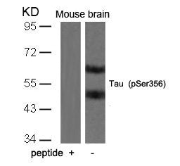 Phospho-MAPT (Ser356) Antibody