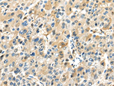 TRAIP Antibody