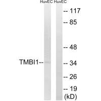 TMBIM1 Antibody
