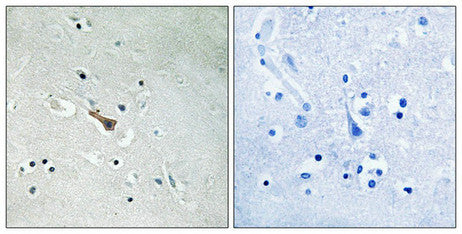 Phospho-APLP2 (Tyr755) Antibody