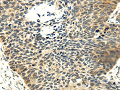 MAP3K7 Antibody