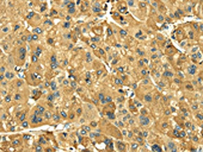 LEP Antibody